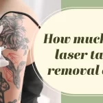 How much does laser tattoo removal cost