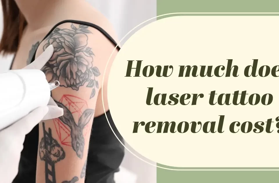 How much does laser tattoo removal cost